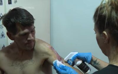 Stigma around drug known for zombie-like effects makes it hard to treat