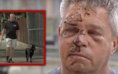 Retired Navy commander requires 100 stitches after savage attack in Philly while walking his dog