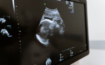Judge places hold on state laws requiring an ultrasound, 24-hour waiting period before performing an abortion