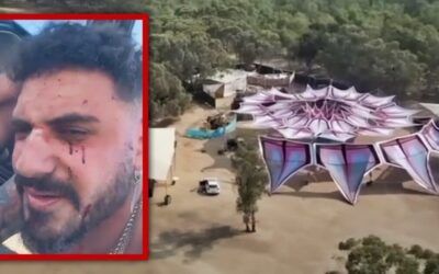 Chicago man shot twice shares horrifying tale of how he survived Hamas attack at Israeli music festival