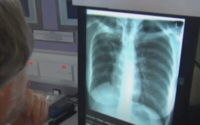 Illegal with ‘aggressive, drug-resistant’ form of TB released after making contact with ‘hundreds of detainees’, state sues