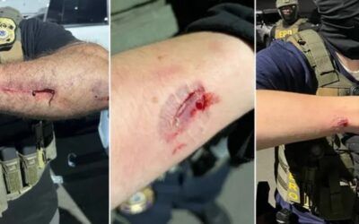 Peaceful protest’ claim collapses as ICE agents are bitten, kicked, endure death threats by savage mob
