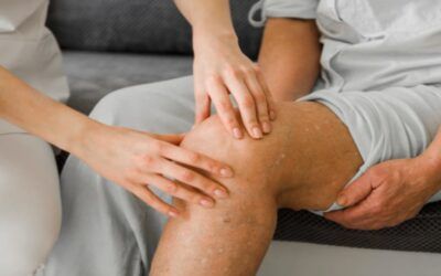 Goodbye, knee surgery? Tiny dissolving particles bring big relief in arthritis study